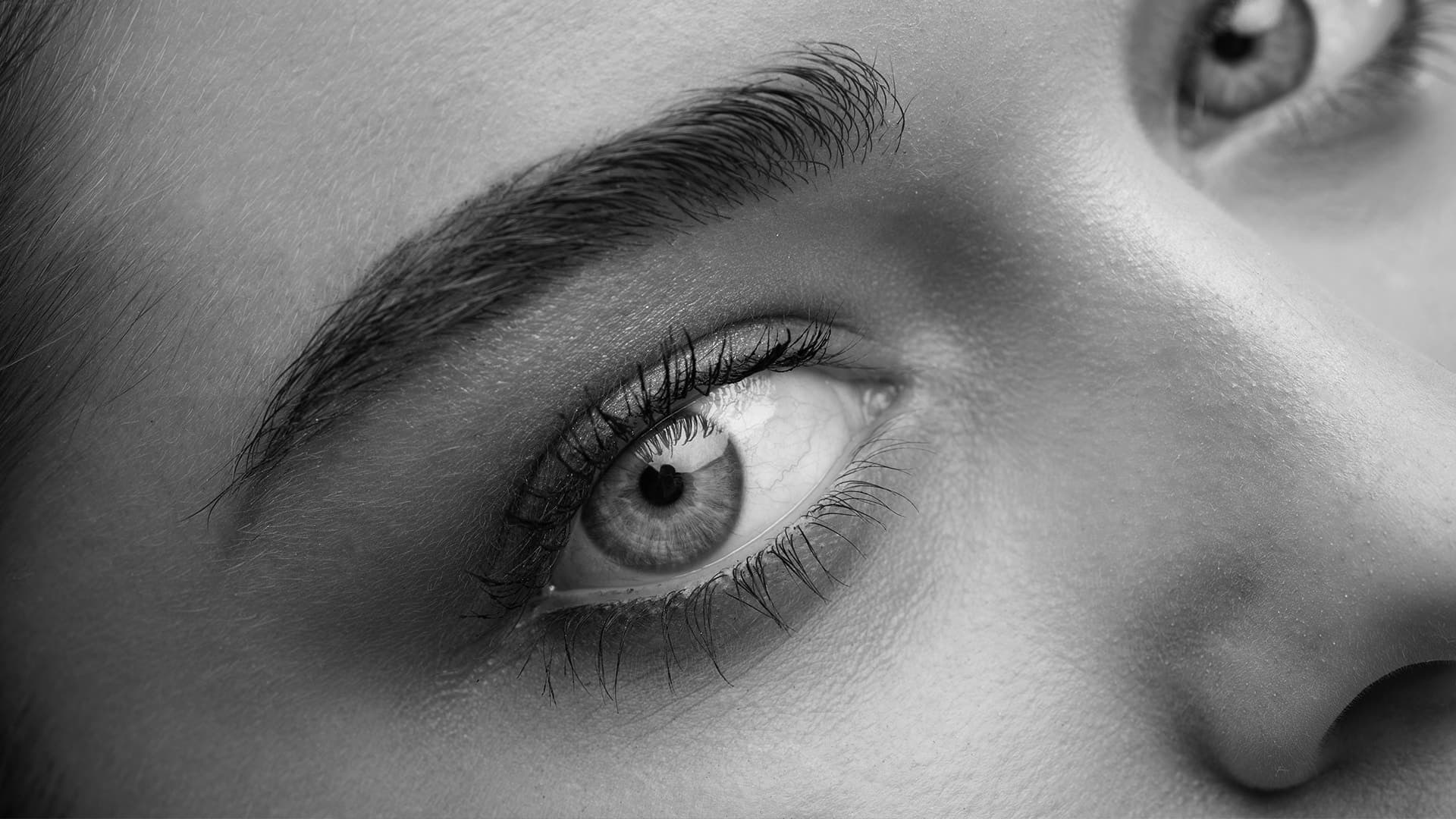 Blefaroplastia