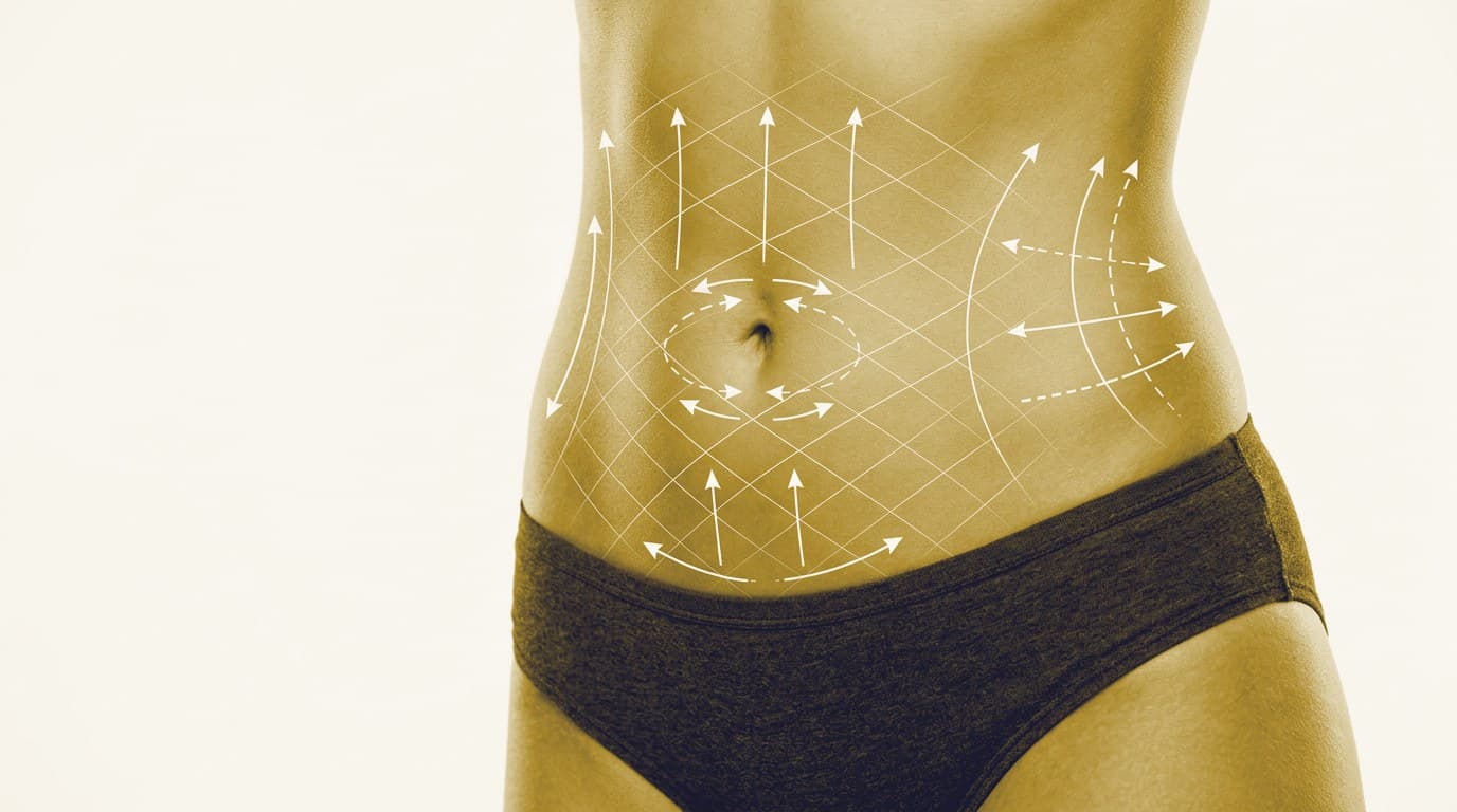 How do I know if I am a suitable person for Liposuction?